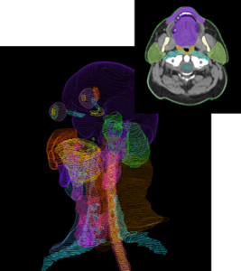Icon Oncology and Limbus AI™ partner to pioneer radiation AI software ...